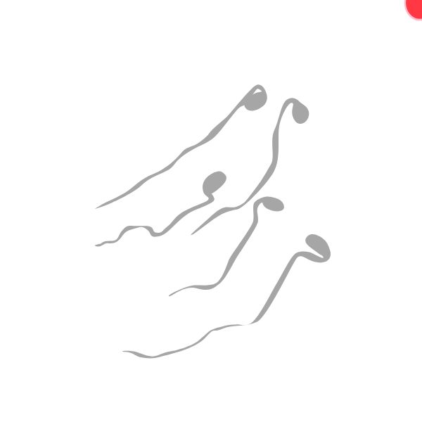 TINH TRÙNG YẾU KÉM -&nbsp;DỊ DẠNG (OAT)